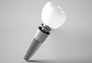 A 3D rendering of a dental implant and its parts