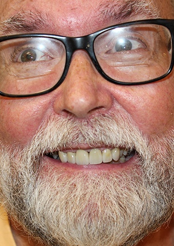 Older man's flawless smile after cosmetic dentistry