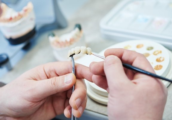Dental technician crafting replacement teeth