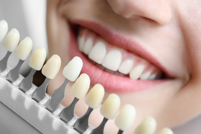 woman smiling looking at shades of teeth