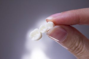 a dental bridge that has fallen out of a patient’s mouth